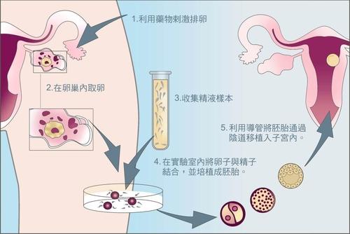 北京正规三代试管婴儿医院排名:北京大学第三医院第三代试管婴儿成功率高